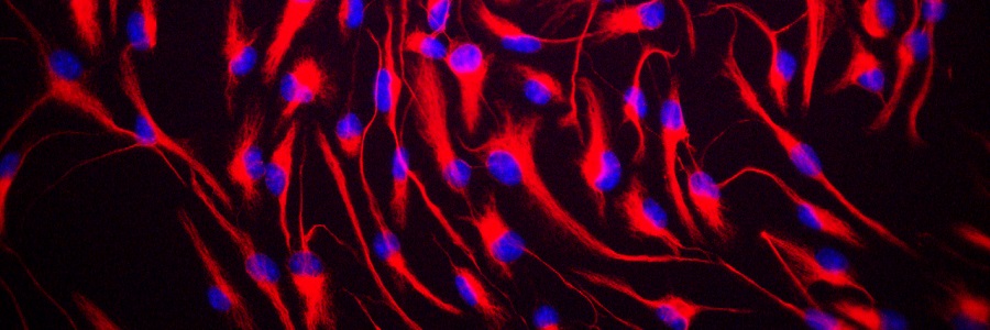 Genes for age-linked brain deterioration identified