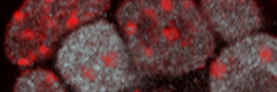 Stem cells know how to open up and unwind